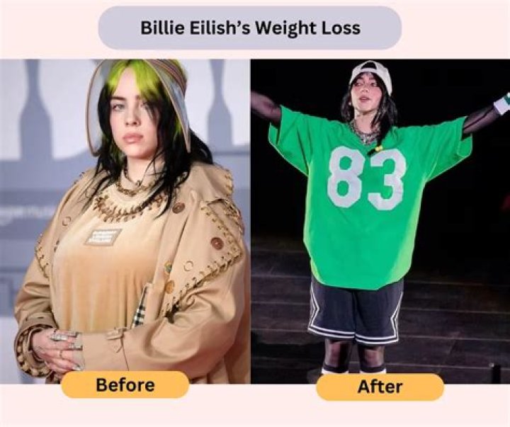 Billie Lee Before And After: Did She Have Surgery?